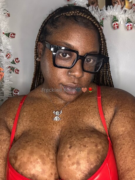 Freckledfantasy5