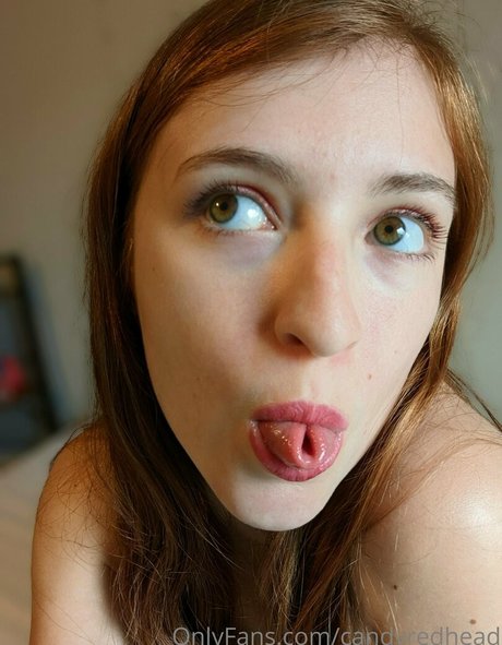 Candyredhead