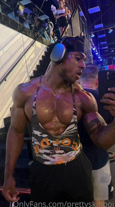 Prettyskinboi