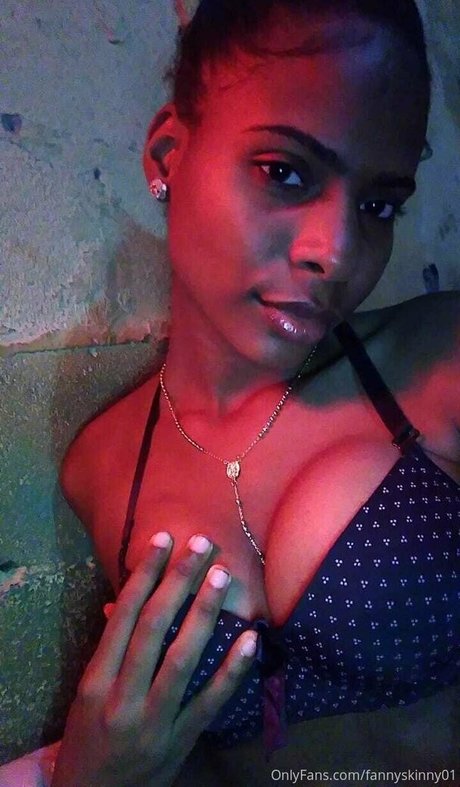 Fannyskinny01